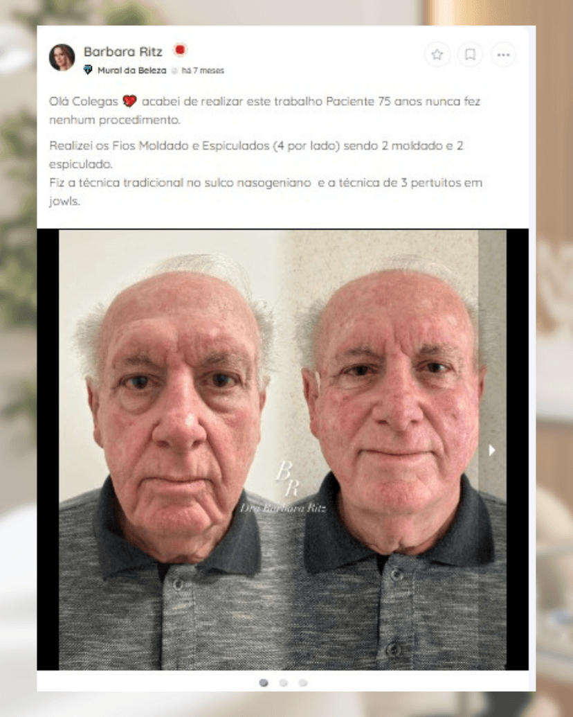 Resultado Barbara Ritz