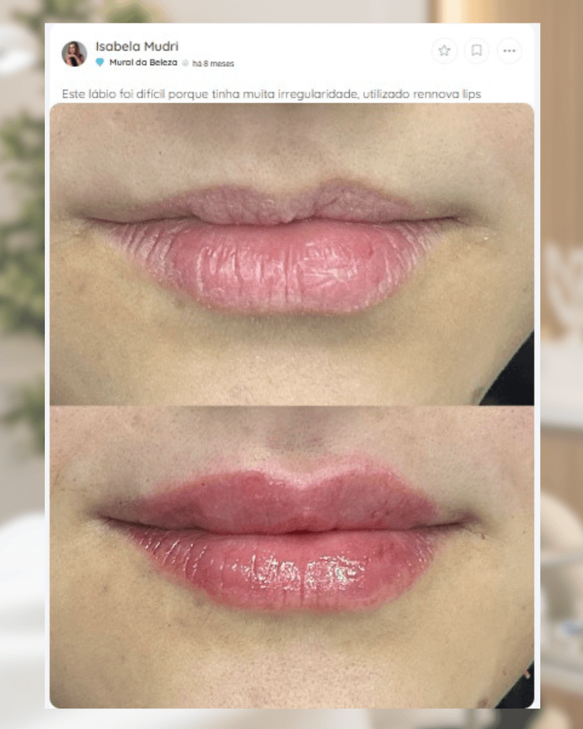 Resultado Isabela Mudri